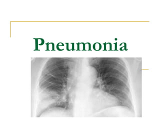 Pneumonia
 