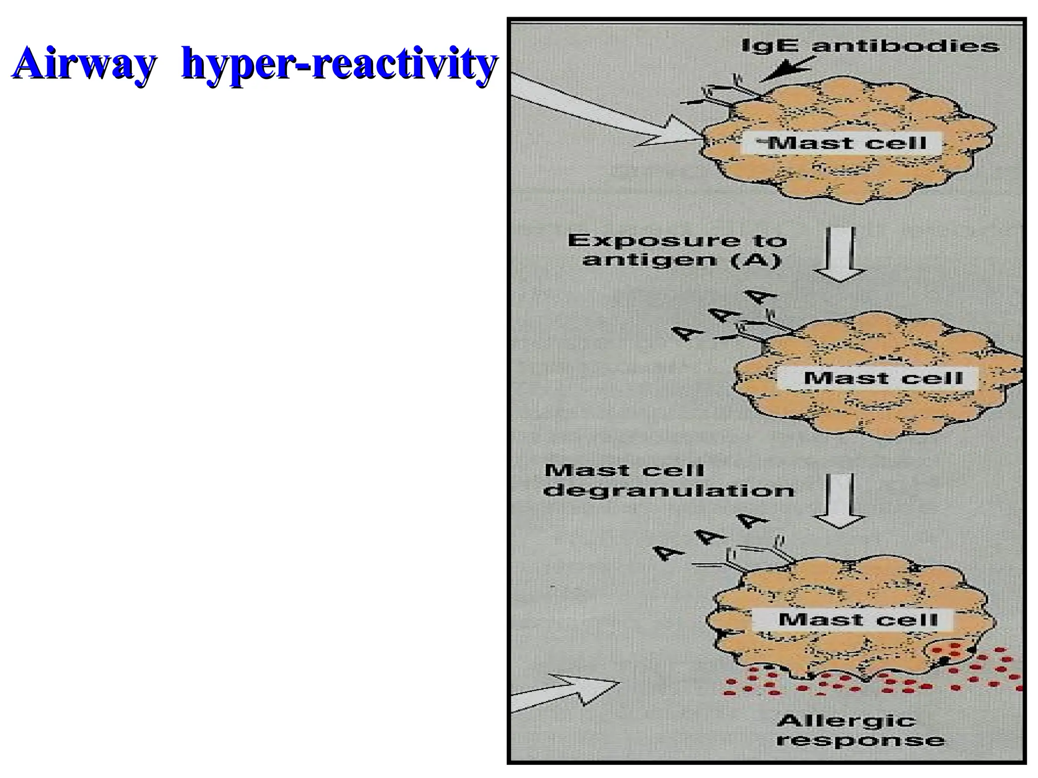 Airway hyper-reactivity
Airway hyper-reactivity
 