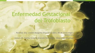 Enfermedad Gestacional
del Trofoblasto
Ponente: Dra. Lisseth Margarita Dinarte Escolero. R2 de Ginecología y
Obstetricia.
Asesor: Dr. Stanley Antonio Alvarado Hernández - Ginecólogo-Oncólogo.
 