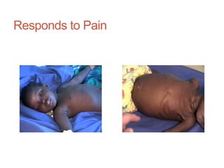 Responds to Pain
 