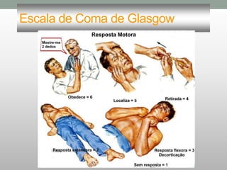 Escala de Coma de Glasgow
 