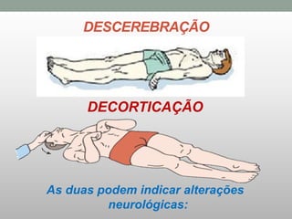 DESCEREBRAÇÃO
DECORTICAÇÃO
As duas podem indicar alterações
neurológicas:
 