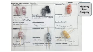 Gummy
Bear
Surgery
 