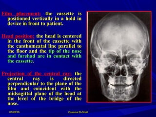 2 extra-oral radiography[1] | PPT