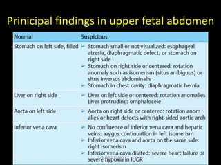 Prinicipal findings in upper fetal abdomen
Dr/AHMED ESAWY
 