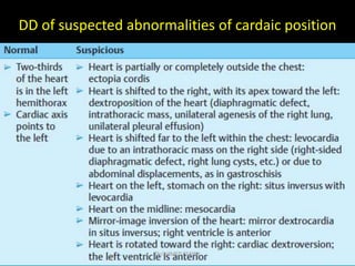DD of suspected abnormalities of cardaic position
Dr/AHMED ESAWY
 