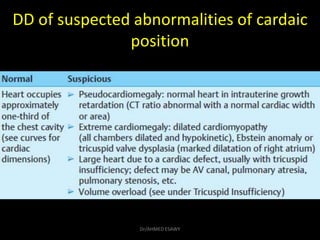 DD of suspected abnormalities of cardaic
position
Dr/AHMED ESAWY
 