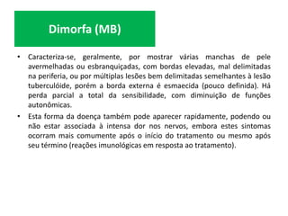 • Caracteriza-se, geralmente, por mostrar várias manchas de pele
avermelhadas ou esbranquiçadas, com bordas elevadas, mal delimitadas
na periferia, ou por múltiplas lesões bem delimitadas semelhantes à lesão
tuberculóide, porém a borda externa é esmaecida (pouco definida). Há
perda parcial a total da sensibilidade, com diminuição de funções
autonômicas.
• Esta forma da doença também pode aparecer rapidamente, podendo ou
não estar associada à intensa dor nos nervos, embora estes sintomas
ocorram mais comumente após o início do tratamento ou mesmo após
seu término (reações imunológicas em resposta ao tratamento).
Dimorfa (MB)
 