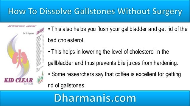 How to Get Rid of Gallstones