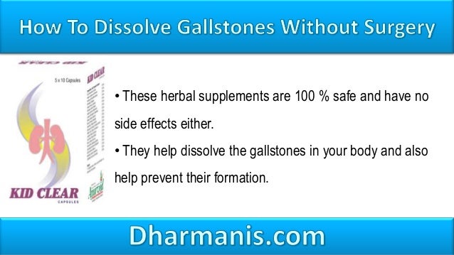 Ways To Get Rid Of Gallstones Naturally Ways To Get Rid Of Gallstones Naturally