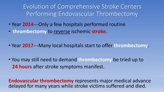 Rapidly Changing Window of Time
to Reverse Acute Ischemic Stroke
►3-5 hours using clot-dissolving drug therapy (1996-2012)...