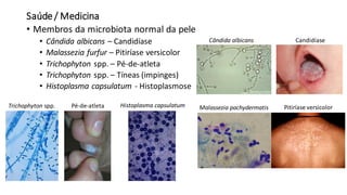 Saúde/ Medicina
• Membros da microbiota normal da pele
• Cândida albicans – Candidíase
• Malassezia furfur – Pitiríase versicolor
• Trichophyton spp. – Pé-de-atleta
• Trichophyton spp. – Tíneas (impinges)
• Histoplasma capsulatum - Histoplasmose
Malassezia pachydermatis
Cândida albicans Candidíase
Pitiríase versicolorTrichophyton spp. Pé-de-atleta Histoplasma capsulatum
 