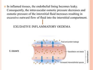  In inflamed tissues, the endothelial lining becomes leaky.
Consequently, the intravascular osmotic pressure decreases and
osmotic pressure of the interstitial fluid increases resulting in
excessive outward flow of fluid into the interstitial compartment.
EXUDATIVE INFLAMMATORY OEDEMA
 