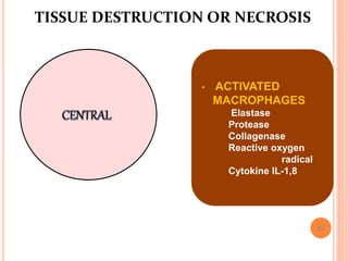 57
TISSUE DESTRUCTION OR NECROSIS
• ACTIVATED
MACROPHAGES
Elastase
Protease
Collagenase
Reactive oxygen
radical
Cytokine IL-1,8
 