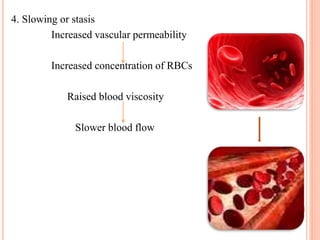 4. Slowing or stasis
Increased vascular permeability
Increased concentration of RBCs
Raised blood viscosity
Slower blood flow
 