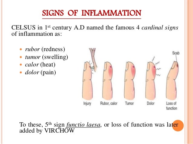 5 Cardinal Signs Of Inflammation Cells Of Immunity And Inflammation 5-cardinal-signs-of-inflammation-cells-of-immunity-and-inflammation