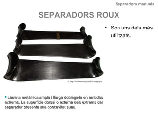 Separadors manuals
SEPARADORS ROUX
• Son uns dels més
utilitzats.
Làmina metàl·lica ampla i llarga doblegada en ambdósLàmina metàl·lica ampla i llarga doblegada en ambdós
extrems. La superfície dorsal o externa dels extrems delextrems. La superfície dorsal o externa dels extrems del
separador presenta una concavitat suau.separador presenta una concavitat suau.
 