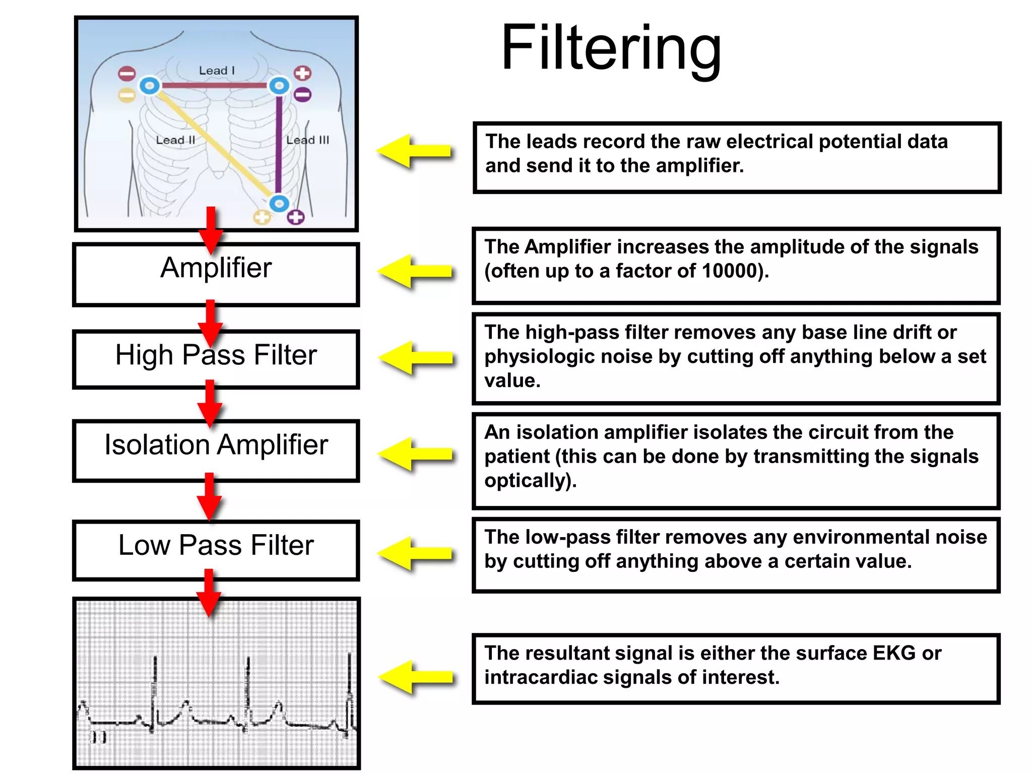Intracardiac Electrograms | PDF