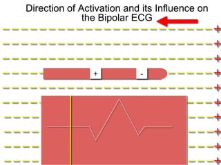 Direction of Activation and its Influence on
                    the Bipolar ECG
–––––––––––––––––––––––+                     –
–––––––––––––––––––––––+                     –
–––––––––––––––––––––––+                     –
– – – – – – – – – –+ – – – – – – – – – – – – +
                   –          -              –
–––––––––––––––––––––––+                     –
–––––––––––––––––––––––+                     –
– – – – – – – – – – – – – – – – – – – – – – –+
                                             –
– – – – – – – – – – – – – – – – – – – – – – –+
                                             –
– – – – – – – – – – – – – – – – – – – – – – –+
                                             –
– – – – – – – – – – – – – – – – – – – – – – –+
 11
                                             –
 