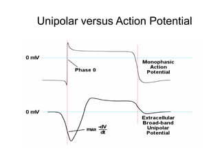 Unipolar versus Action Potential




15
 