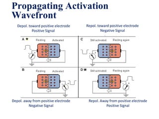 Propagating Activation
     Wavefront
        Depol. toward positive electrode   Repol. toward positive electrode
                 Positive Signal                    Negative Signal




     Depol. away from positive electrode    Repol. Away from positive electrode
              Negative Signal                         Positive Signal
20
 