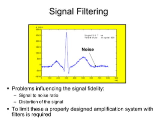 Signal Filtering



                                 Noise




 Problems influencing the signal fidelity:
   – Signal to noise ratio
   – Distortion of the signal
 To limit these a properly designed amplification system with
27 filters is required
 