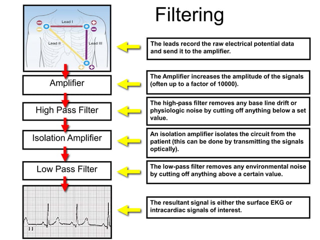 Intracardiac Electrograms | PDF