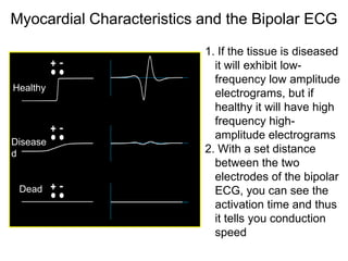 Myocardial Characteristics and the Bipolar ECG

                           1. If the tissue is diseased
                             it will exhibit low-
                             frequency low amplitude
Healthy
                             electrograms, but if
                             healthy it will have high
                             frequency high-
                             amplitude electrograms
Disease
d                          2. With a set distance
                             between the two
                             electrodes of the bipolar
 Dead                        ECG, you can see the
                             activation time and thus
                             it tells you conduction
                             speed
44
 