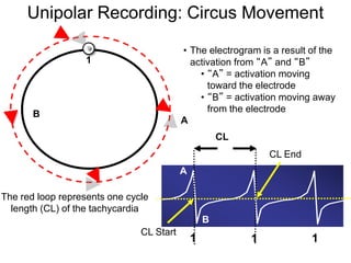 Unipolar Recording: Circus Movement

                                          • The electrogram is a result of the
                   1                        activation from “A” and “B”
                                              • “A” = activation moving
                                                toward the electrode
                                              • “B” = activation moving away
                                                from the electrode
        B
                                          A
                                                      CL
                                                               CL End
                                          A

The red loop represents one cycle
  length (CL) of the tachycardia
                                                  B
                               CL Start
                                              1            1            1
   47
 