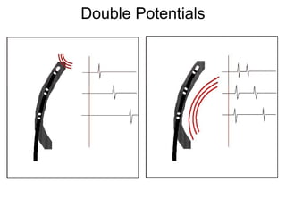 Double Potentials




50
 