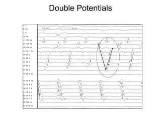 Double Potentials




52
 