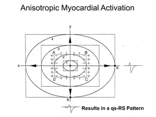 Anisotropic Myocardial Activation




                      Results in a qs-RS Pattern
57
 