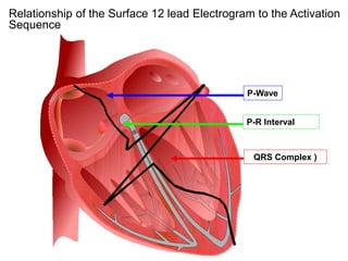 Relationship of the Surface 12 lead Electrogram to the Activation
Sequence




                                              P-Wave


                                              P-R Interval



                                                QRS Complex )




 68
 