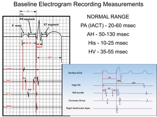 Baseline Electrogram Recording Measurements

         PR segment
                                               NORMAL RANGE
     P wave                     ST segment
                                             PA (IACT) - 20-60 msec
                                               AH - 50-130 msec
                                                His - 10-25 msec
                                                HV - 35-55 msec



              P-A         H-V




                    A-H




82
 