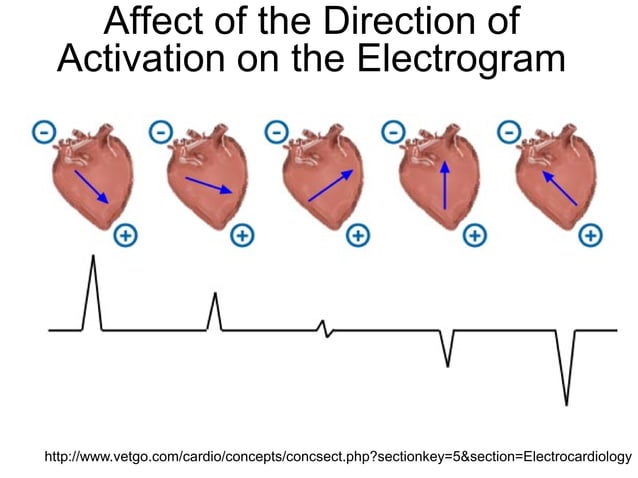 Intracardiac Electrograms | PDF