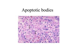 Irreversible cell injury pathology for medicine | PPT