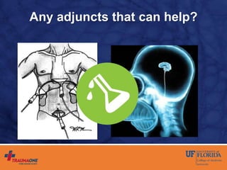 Any adjuncts that can help?
 