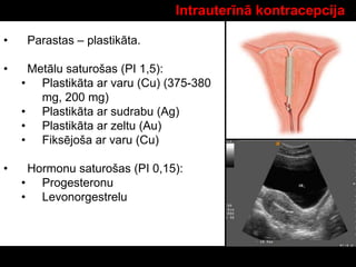 Intrauterīnā kontracepcija
• Parastas – plastikāta.
• Metālu saturošas (PI 1,5):
• Plastikāta ar varu (Cu) (375-380
mg, 200 mg)
• Plastikāta ar sudrabu (Ag)
• Plastikāta ar zeltu (Au)
• Fiksējoša ar varu (Cu)
• Hormonu saturošas (PI 0,15):
• Progesteronu
• Levonorgestrelu
 