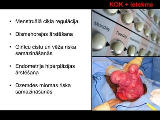 KOK + ietekme
• Menstruālā cikla regulācija
• Dismenorejas ārstēšana
• Olnīcu cistu un vēža riska
samazināšanās
• Endometrija hiperplāzijas
ārstēšana
• Dzemdes miomas riska
samazināšanās
 