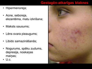 Gestagēn-atkarīgas blaknes
• Hipermenoreja;
• Acne, seboreja,
ekzantēma, matu izkrišana;
• Maksts sausums;
• Lēns svara pieaugums;
• Libido samazināšanās;
• Nogurums, spēku zudums,
depresija, noskaņas
maiņas;
• U.c.
 