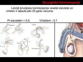 Latvijā ķirurģiska kontracepcija veselai sievietei un
vīrietim ir atļauta pēc 25 gadu vecuma.
PI sievietēm = 0,5, Vīriešiem - 0,1
Ķirurģiskā kontracepcija
 