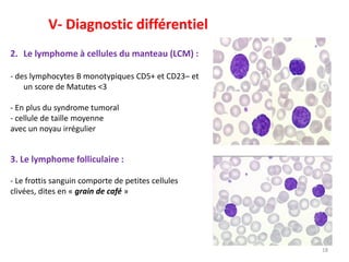 18
2. Le lymphome à cellules du manteau (LCM) :
- des lymphocytes B monotypiques CD5+ et CD23– et
un score de Matutes <3
- En plus du syndrome tumoral
- cellule de taille moyenne
avec un noyau irrégulier
V- Diagnostic différentiel
3. Le lymphome folliculaire :
- Le frottis sanguin comporte de petites cellules
clivées, dites en « grain de café »
 