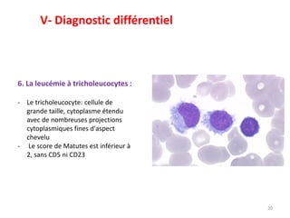 20
6. La leucémie à tricholeucocytes :
- Le tricholeucocyte: cellule de
grande taille, cytoplasme étendu
avec de nombreuses projections
cytoplasmiques fines d'aspect
chevelu
- Le score de Matutes est inférieur à
2, sans CD5 ni CD23
V- Diagnostic différentiel
 