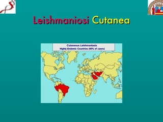 Leishmaniosi   Cutanea 