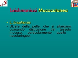 Leishmaniosi   Mucocutanea L. braziliensis Ulcere della pelle, che si allargano cuasando distruzione del tessuto mucoso, particolarmente quello  nasofaringeo. 