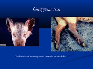 Gangrena seca
Geralmente tem causa isquêmica, afetando extremidades
 