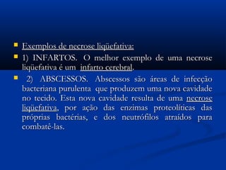  Exemplos de necrose liqüefativa:Exemplos de necrose liqüefativa:
 1) INFARTOS.  O melhor exemplo de uma necrose1) INFARTOS.  O melhor exemplo de uma necrose
liqüefativa é um liqüefativa é um  infarto cerebralinfarto cerebral. . 
 2)  ABSCESSOS.  Abscessos são áreas de infecção2)  ABSCESSOS.  Abscessos são áreas de infecção
bacteriana purulenta  que produzem uma nova cavidadebacteriana purulenta  que produzem uma nova cavidade
no tecido. Esta nova cavidade resulta de umano tecido. Esta nova cavidade resulta de uma necrosenecrose
liqüefativaliqüefativa, por ação das enzimas proteolíticas das, por ação das enzimas proteolíticas das
próprias bactérias, e dos neutrófilos atraídos parapróprias bactérias, e dos neutrófilos atraídos para
combatê-las.combatê-las.
 