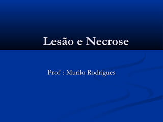 Lesão e NecroseLesão e Necrose
Prof : Murilo RodriguesProf : Murilo Rodrigues
 