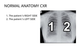 Comprehensive Radiological Diagnosis of Lung Diseases Using Chest X-Ray ...
