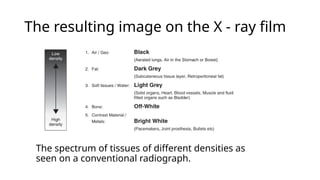 Comprehensive Radiological Diagnosis of Lung Diseases Using Chest X-Ray ...